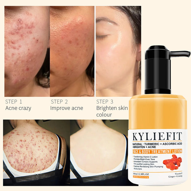 Anti Aging Skin Care Firming Brightening Lotion Reduces Uneven Skin Tone Age Spots Sun Damaged Skin - My Variety Superstore 25