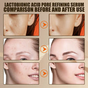 3pcs Lactobionic Acid Pore Shrinking Facial Serum Firming and Moisturizing Blackhead and Acne Cleansing Skin Care Products