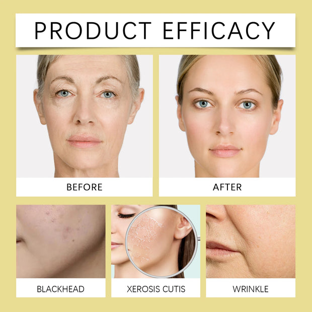 Ouhoe Bee Venom Facial Essence for Lightening Fine Lines and Wrinkles Moisturizing and Firming Skin Essence