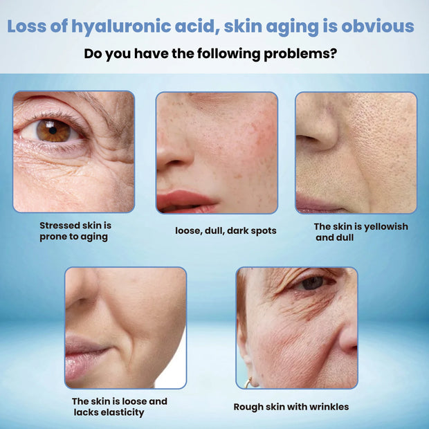 15ml Hyaluronic Acid Propylene Glycol Facial Essence Collagen Serum Skin Care Whitening Lightens Spots