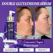 AILKE Skin Whitening Set With Double Glutathione Moisturizing Dark Spot Removal Hyperpigmentation Treatment