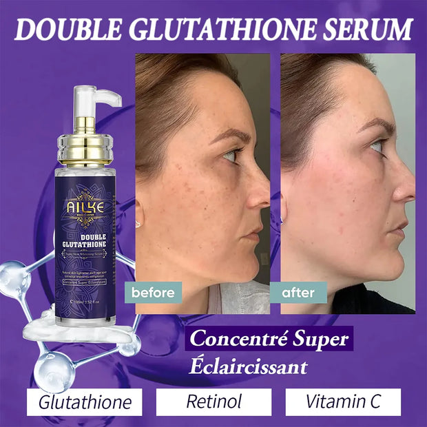 AILKE Skin Whitening Set With Double Glutathione Moisturizing Dark Spot Removal Hyperpigmentation Treatment