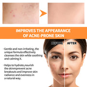 EELHOE Turmeric Skin Care Face Cream Serum Oil Stick Mask for Body Whitening Anti Acne Dark Spot Lightening Moisturizing