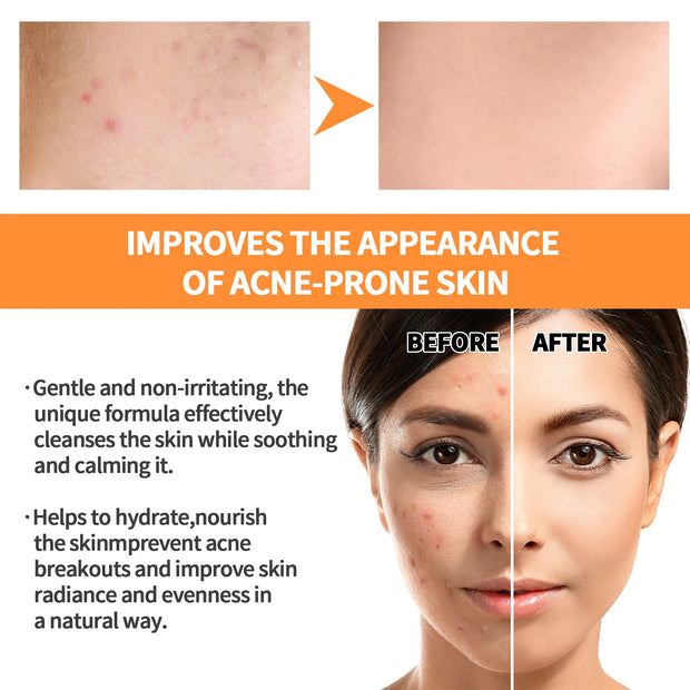 EELHOE Turmeric Skin Care Face Cream Serum Oil Stick Mask for Body Whitening Anti Acne Dark Spot Lightening Moisturizing