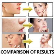 Bee Venom Face Cream Hydrating Moisturizing Firming Facial Care 50g