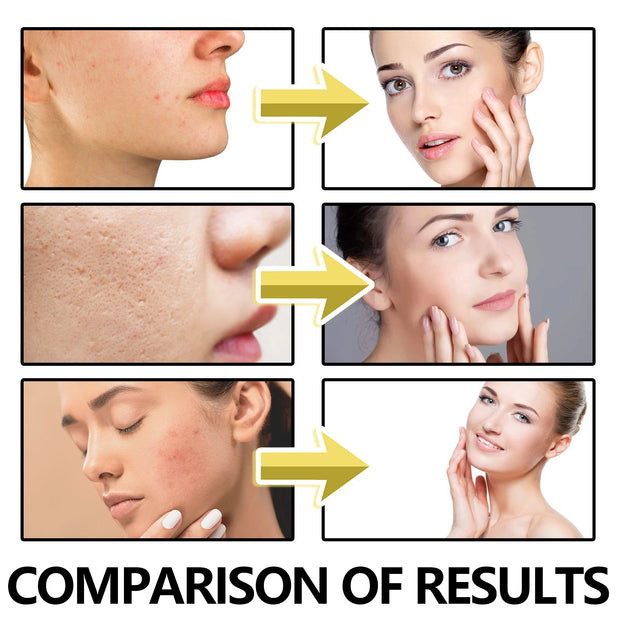 Bee Venom Face Cream Hydrating Moisturizing Firming Facial Care 50g
