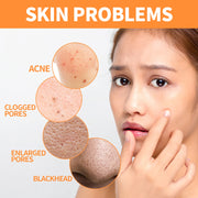 EELHOE Turmeric Skin Care Face Cream Serum Oil Stick Mask for Body Whitening Anti Acne Dark Spot Lightening Moisturizing