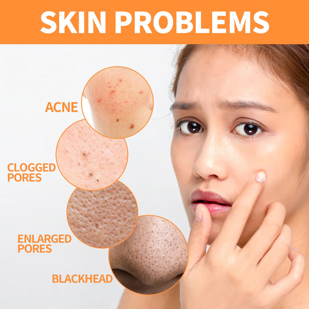 EELHOE Turmeric Skin Care Face Cream Serum Oil Stick Mask for Body Whitening Anti Acne Dark Spot Lightening Moisturizing