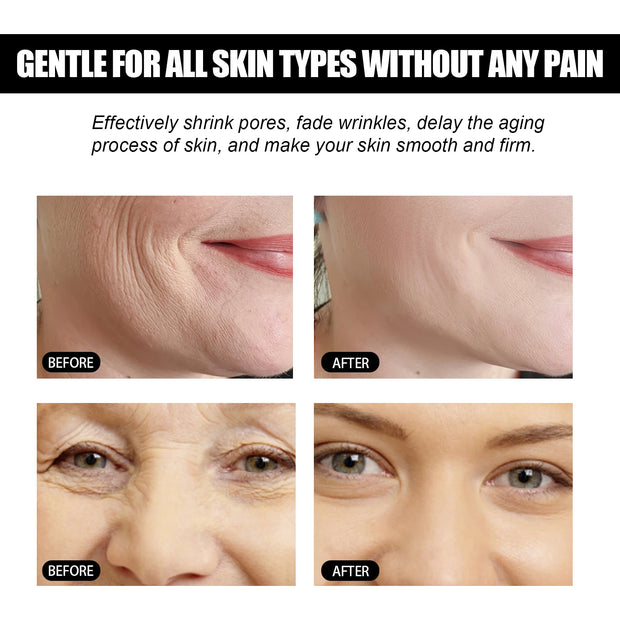 Skin Lifting Glycerin Lotion With Vitamin C For Reducing Wrinkles Moisturizing Skin And Shrinking Pores Facial Skin Care Product